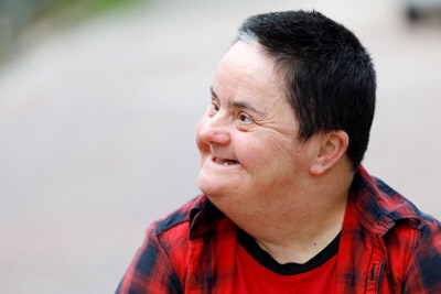 man affected by Alzheimer's disease Down syndrome type