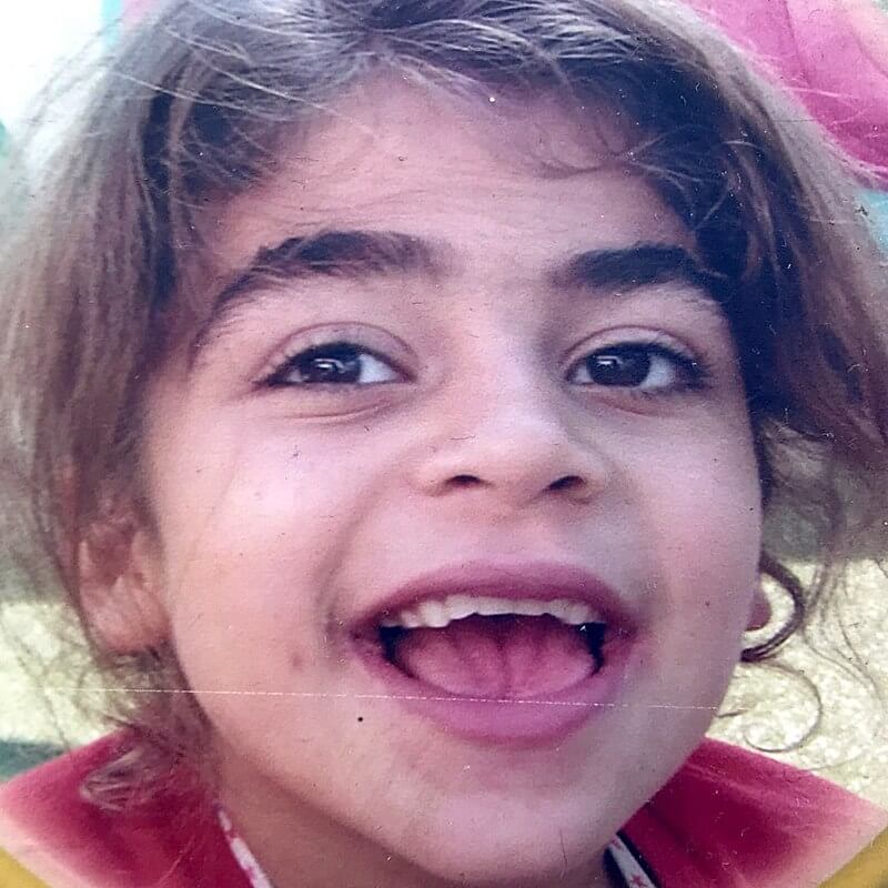 girl with Sanfilippo syndrome that causing childhood dementia