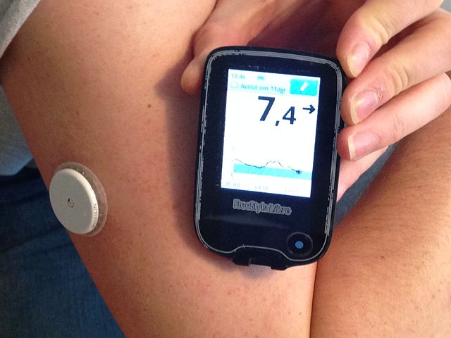 Continuous Glucose Monitoring