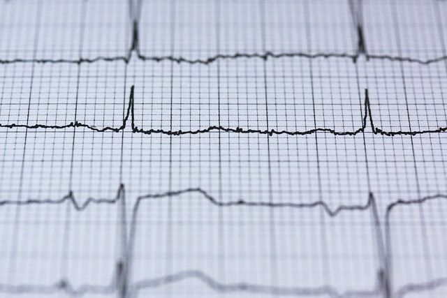 Electrocardiogram