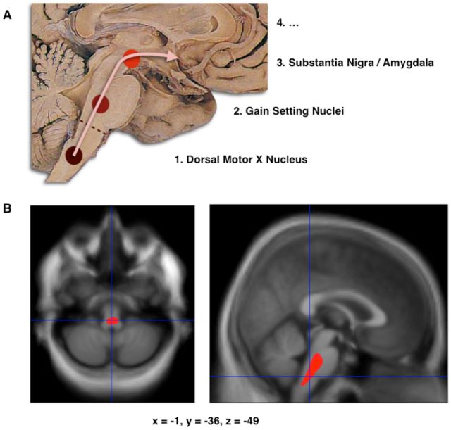 Decoding Parkinson's: Unveiling the Mysteries